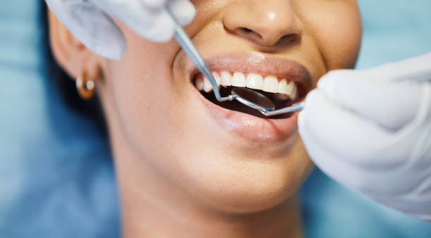 Best Emergency Dental Surgery in Moriarty, NM
